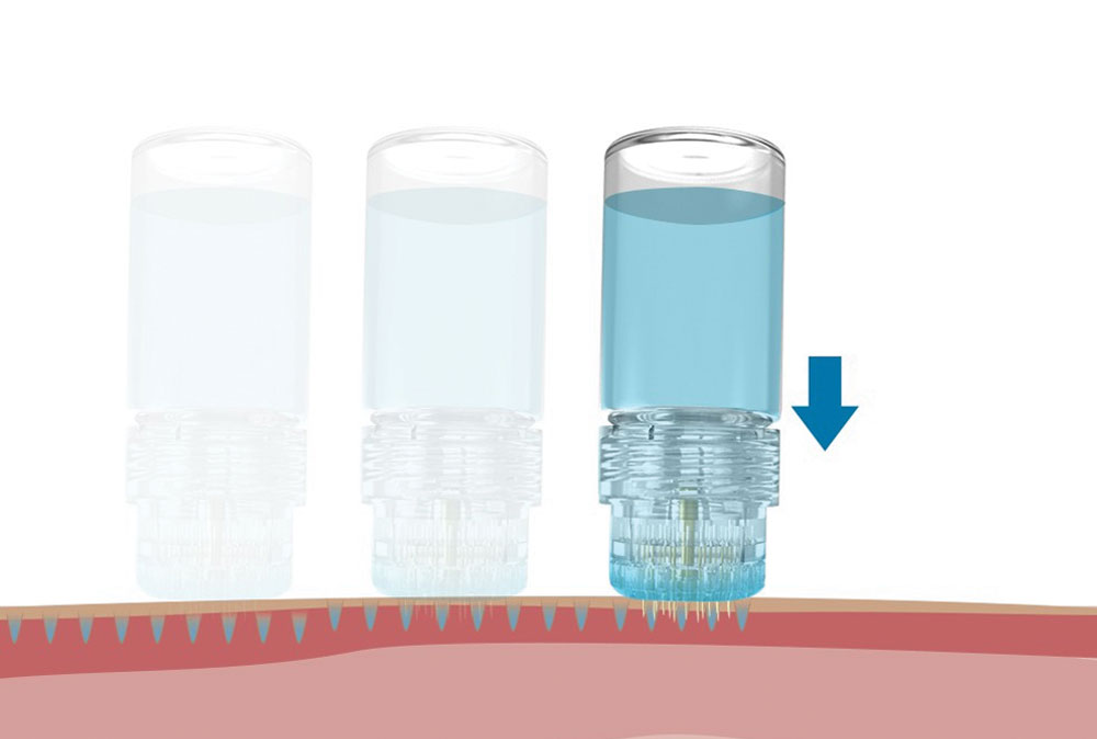 Animation of how the Hydra Needle creates holes